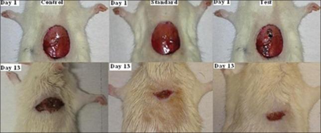 https://cdn.ncbi.nlm.nih.gov/pmc/blobs/d645/4137633/191aef5ff745/IJABMR-4-106-g002.jpg