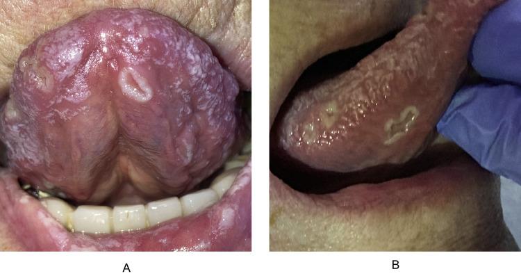 https://cdn.ncbi.nlm.nih.gov/pmc/blobs/d645/9335396/104cf0cec4e2/gr1_lrg.jpg