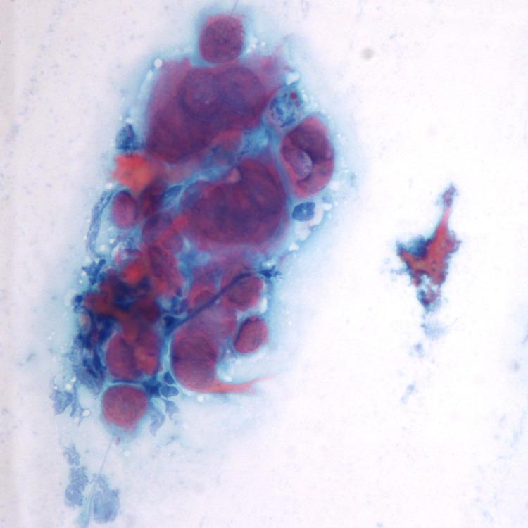 https://cdn.ncbi.nlm.nih.gov/pmc/blobs/d645/9335396/9a068c2eda9c/gr4_lrg.jpg