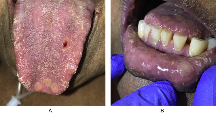 https://cdn.ncbi.nlm.nih.gov/pmc/blobs/d645/9335396/ab9703d485a3/gr2_lrg.jpg