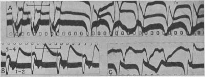 https://cdn.ncbi.nlm.nih.gov/pmc/blobs/d64a/1395260/5e73777b9fb2/jphysiol01576-0046-a.jpg