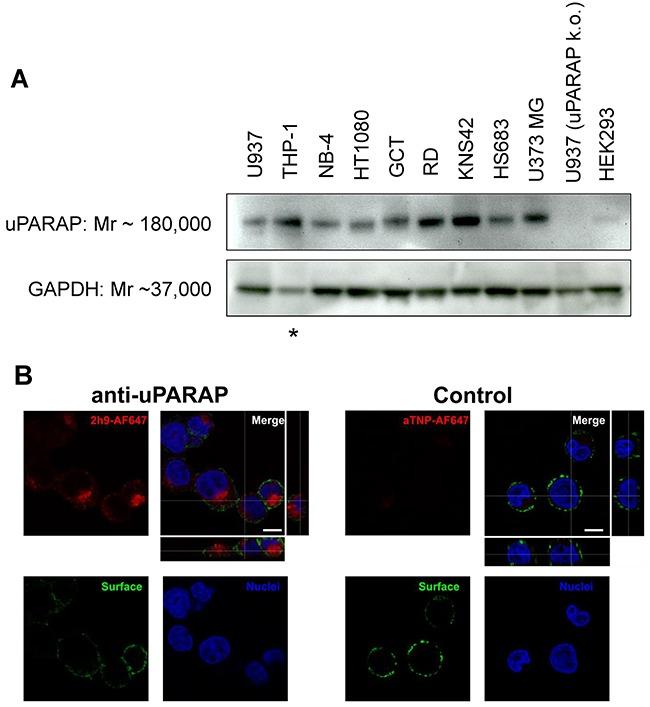 https://cdn.ncbi.nlm.nih.gov/pmc/blobs/d64a/5546505/28de1fdece96/oncotarget-08-44605-g001.jpg