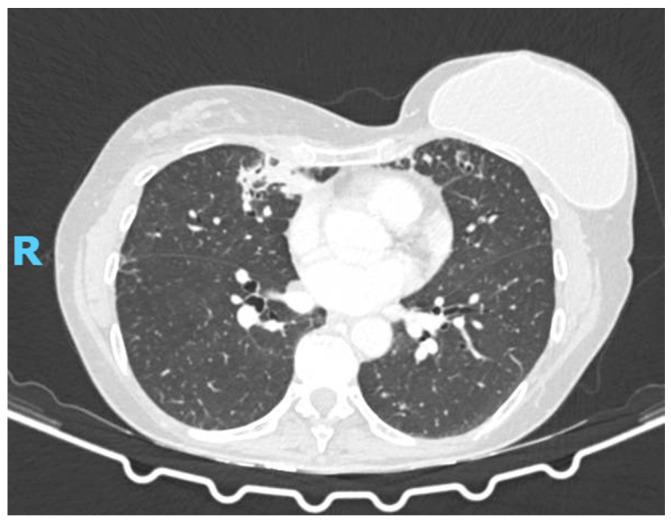 https://cdn.ncbi.nlm.nih.gov/pmc/blobs/d64e/12249320/af5fe960b71f/diagnostics-15-01661-g002a.jpg