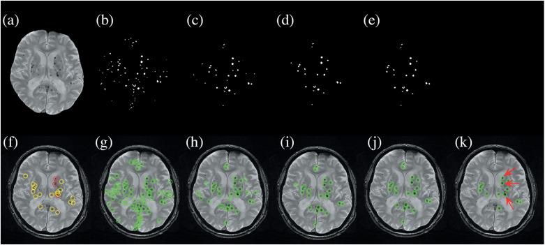 https://cdn.ncbi.nlm.nih.gov/pmc/blobs/d65a/11996243/8a199314f326/mrms-24-220-g4.jpg