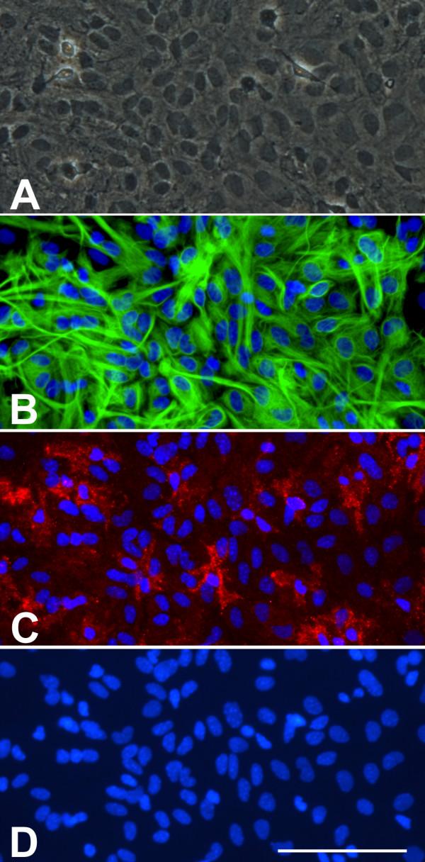 https://cdn.ncbi.nlm.nih.gov/pmc/blobs/d65d/2140055/21eab8ba3e43/1742-2094-4-26-1.jpg