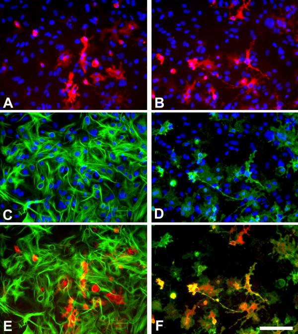 https://cdn.ncbi.nlm.nih.gov/pmc/blobs/d65d/2140055/45684f735ca0/1742-2094-4-26-2.jpg