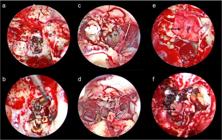 https://cdn.ncbi.nlm.nih.gov/pmc/blobs/d65f/8947636/64666b719b14/curroncol-29-00118-g002.jpg