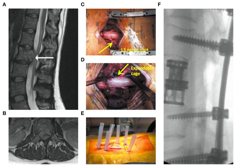 https://cdn.ncbi.nlm.nih.gov/pmc/blobs/d662/8084350/c7d8c72bee0f/fsurg-08-626873-g0004.jpg