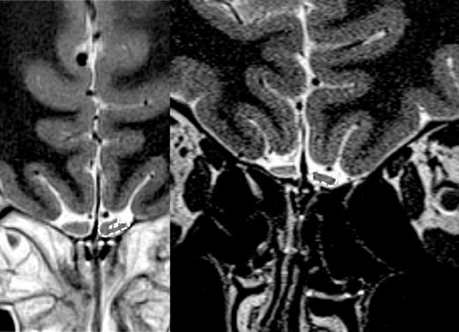 https://cdn.ncbi.nlm.nih.gov/pmc/blobs/d668/7571972/84d50135355c/gr1_lrg.jpg