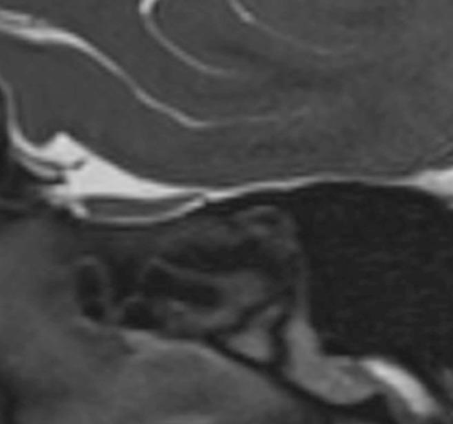 https://cdn.ncbi.nlm.nih.gov/pmc/blobs/d668/7571972/e68c60e666bd/gr5_lrg.jpg
