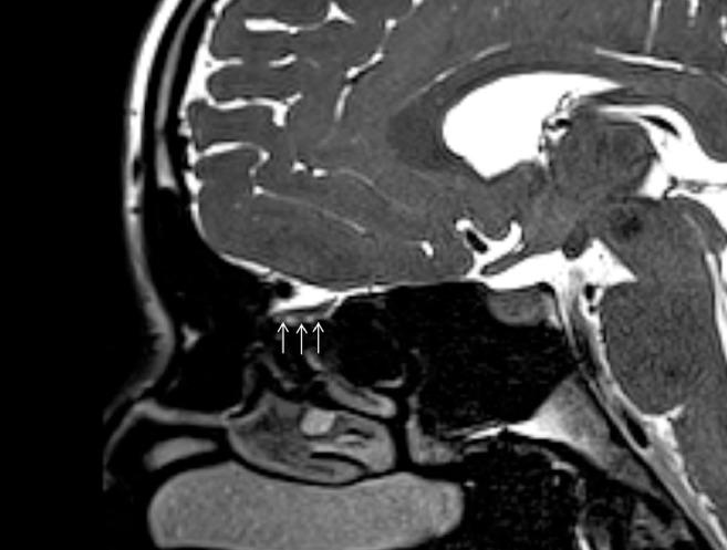 https://cdn.ncbi.nlm.nih.gov/pmc/blobs/d668/7571972/ec4d43474c60/gr6_lrg.jpg