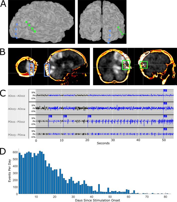 https://cdn.ncbi.nlm.nih.gov/pmc/blobs/d674/8164849/23c14ff2aca6/ACN3-8-1353-g002.jpg