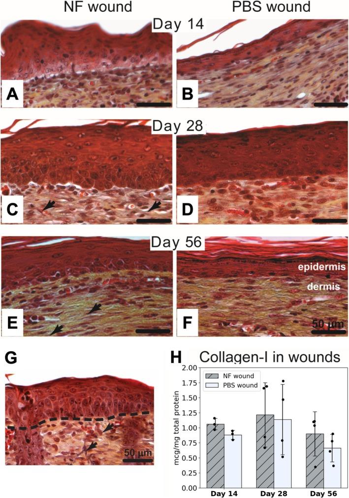 https://cdn.ncbi.nlm.nih.gov/pmc/blobs/d67d/12406645/2f79d8d81e98/WRR-33-0-g003.jpg