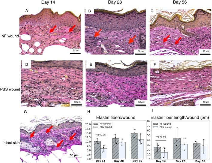 https://cdn.ncbi.nlm.nih.gov/pmc/blobs/d67d/12406645/e91992e7941f/WRR-33-0-g005.jpg