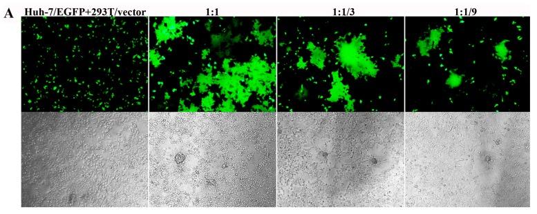https://cdn.ncbi.nlm.nih.gov/pmc/blobs/d67d/5618021/e13d1bde2ae6/viruses-09-00255-g004a.jpg