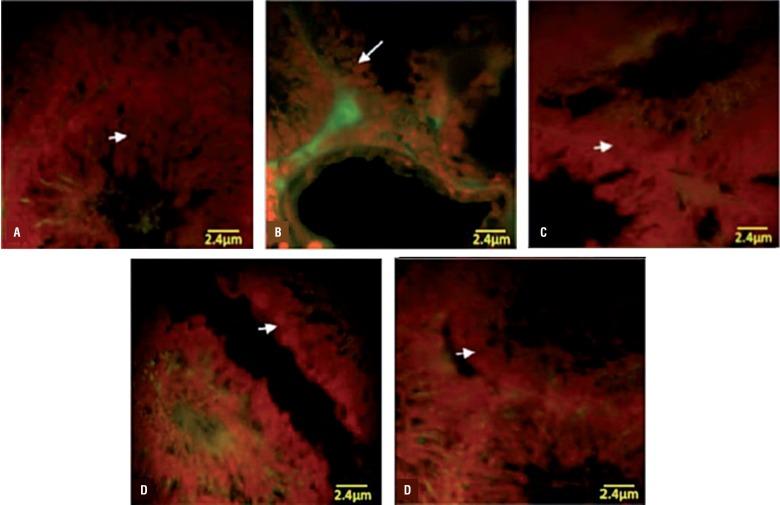 https://cdn.ncbi.nlm.nih.gov/pmc/blobs/d67e/4757008/2838b2b2dd23/1677-5538-ibju-41-4-0773-gf03.jpg