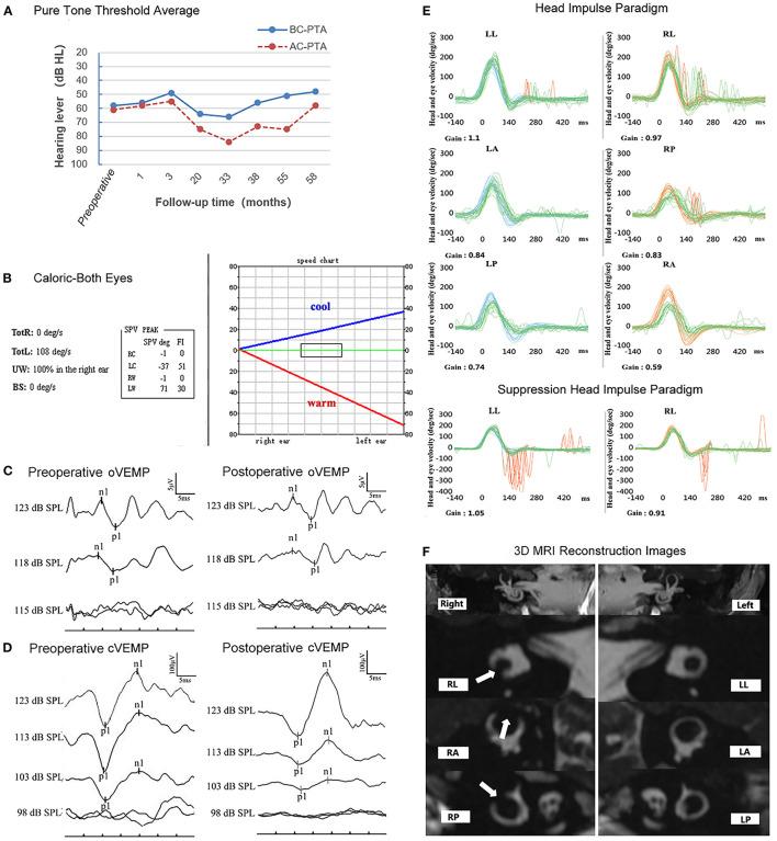 https://cdn.ncbi.nlm.nih.gov/pmc/blobs/d682/8732767/7666a481b53b/fneur-12-713275-g0001.jpg