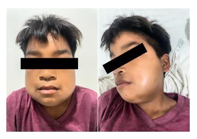 https://cdn.ncbi.nlm.nih.gov/pmc/blobs/d688/11797586/3b80c3bcf8ed/rpmesp-41-04-13614-g003.jpg