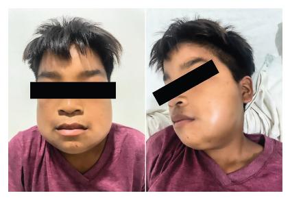 https://cdn.ncbi.nlm.nih.gov/pmc/blobs/d688/11797586/a881173c9996/rpmesp-41-04-13614-g006.jpg