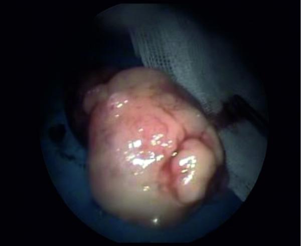 https://cdn.ncbi.nlm.nih.gov/pmc/blobs/d68b/3410769/3268d1a4cbe0/1752-1947-6-147-2.jpg
