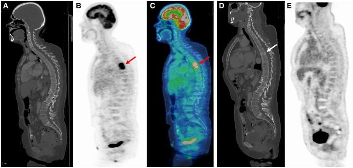 https://cdn.ncbi.nlm.nih.gov/pmc/blobs/d68c/9846188/f0d648c61532/ofac704f1.jpg