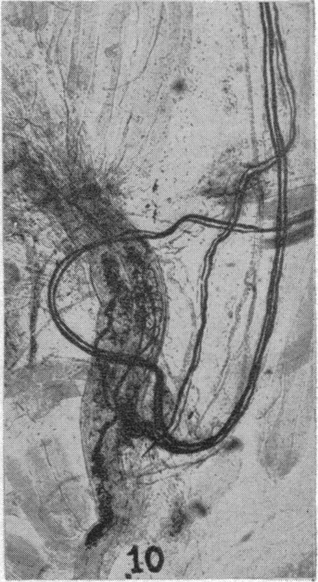 https://cdn.ncbi.nlm.nih.gov/pmc/blobs/d695/1966695/7d1d50264ced/brmedj02909-0035-i.jpg