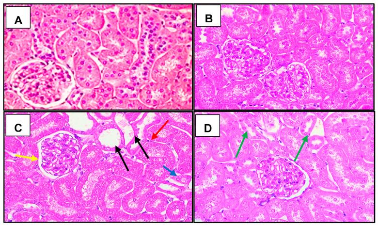 https://cdn.ncbi.nlm.nih.gov/pmc/blobs/d6a1/10341095/3302ad81eab8/cells-12-01688-g006.jpg