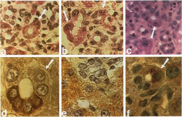 https://cdn.ncbi.nlm.nih.gov/pmc/blobs/d6a1/1886241/b70aa399250a/amjpathol00085-0134-a.jpg