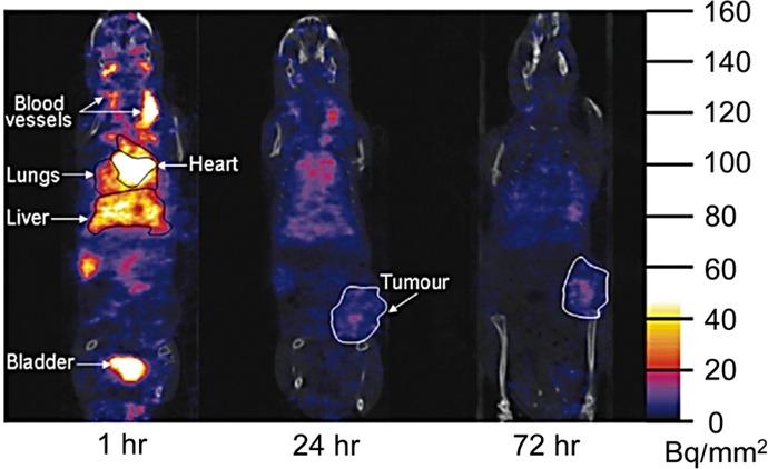 https://cdn.ncbi.nlm.nih.gov/pmc/blobs/d6ac/4702217/a9052c52a202/mp-2015-00626m_0005.jpg