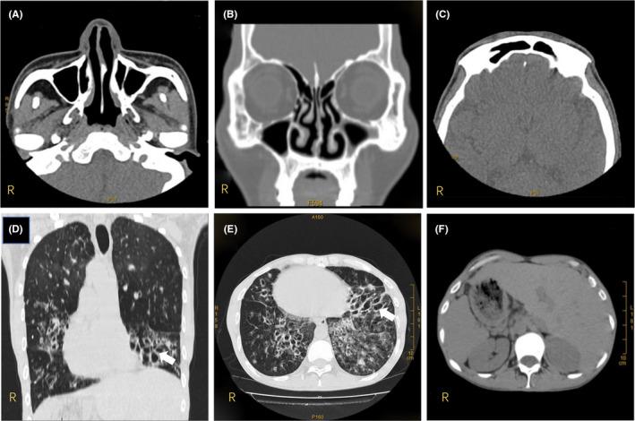 https://cdn.ncbi.nlm.nih.gov/pmc/blobs/d6b0/8435457/8c86a1b1366a/JCMM-25-9028-g001.jpg