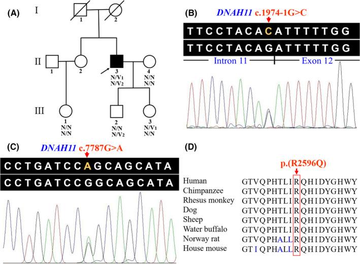 https://cdn.ncbi.nlm.nih.gov/pmc/blobs/d6b0/8435457/d4236da97552/JCMM-25-9028-g003.jpg