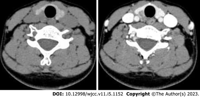 https://cdn.ncbi.nlm.nih.gov/pmc/blobs/d6b5/9979281/54c80cbdb755/WJCC-11-1152-g002.jpg