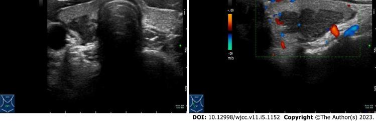 https://cdn.ncbi.nlm.nih.gov/pmc/blobs/d6b5/9979281/9577d6171c67/WJCC-11-1152-g001.jpg