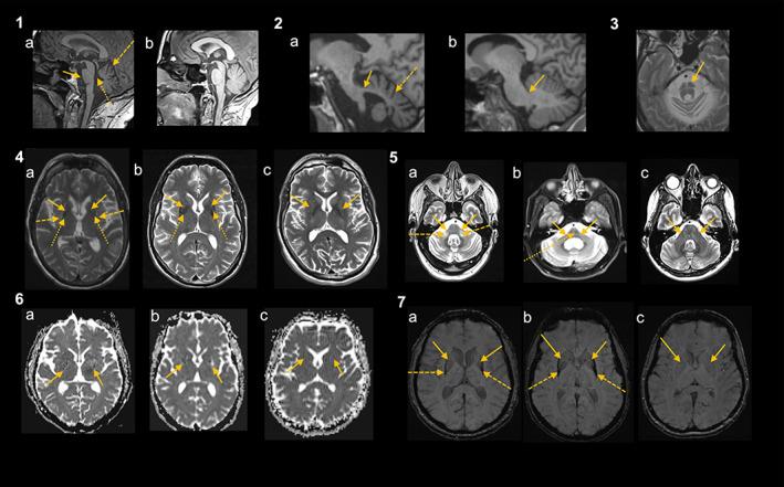 https://cdn.ncbi.nlm.nih.gov/pmc/blobs/d6ba/9321158/b2fa6c654920/MDS-37-1131-g002.jpg