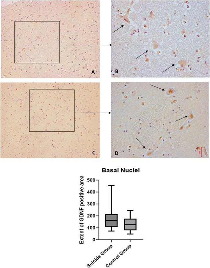 https://cdn.ncbi.nlm.nih.gov/pmc/blobs/d6c0/11335659/c655f0e62762/fphar-15-1392832-g008.jpg