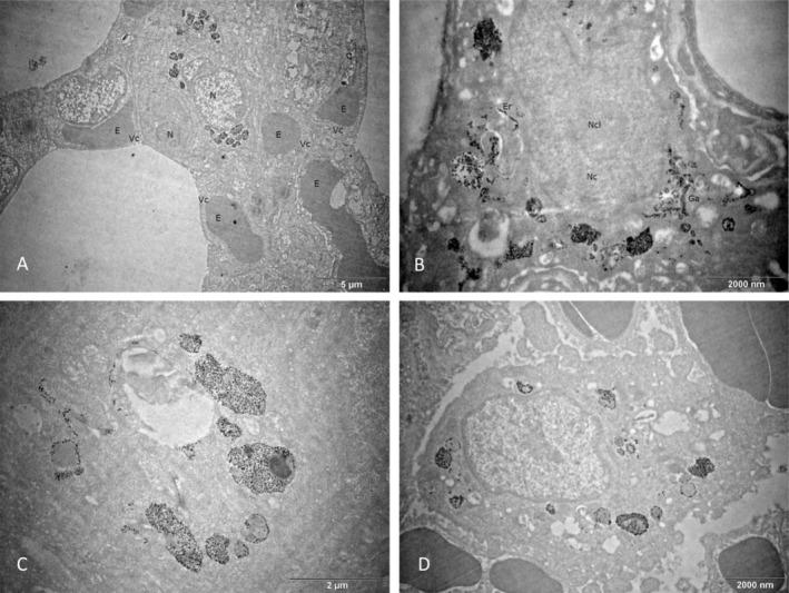 https://cdn.ncbi.nlm.nih.gov/pmc/blobs/d6cb/12061548/4ceba4c1ca72/JAT-45-1004-g009.jpg