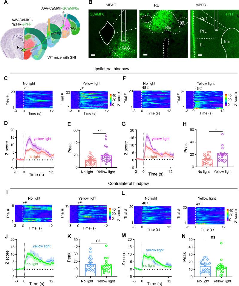 https://cdn.ncbi.nlm.nih.gov/pmc/blobs/d6d3/12091829/269fea835f56/pbio.3003170.g006.jpg