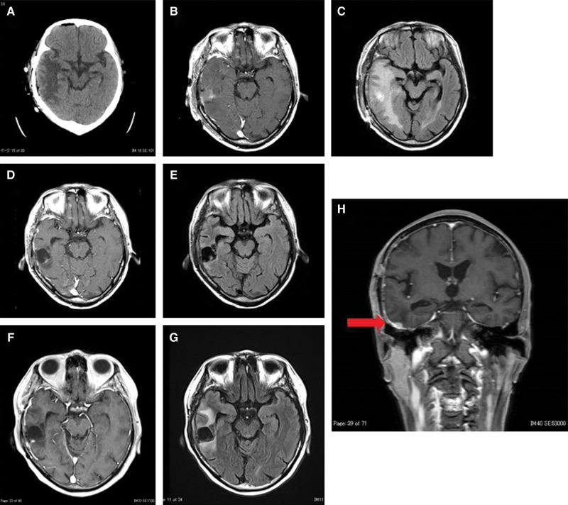 https://cdn.ncbi.nlm.nih.gov/pmc/blobs/d6db/7538455/40a8a9ec2d27/nmccrj-7-189-g004.jpg