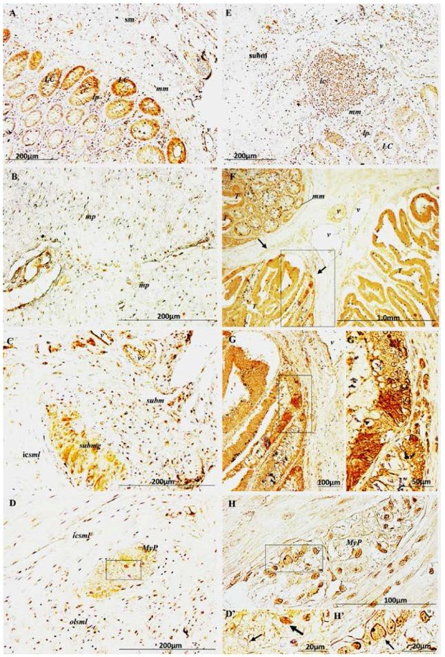 https://cdn.ncbi.nlm.nih.gov/pmc/blobs/d6dc/5412470/fda1aacd2223/ijms-18-00891-g002.jpg