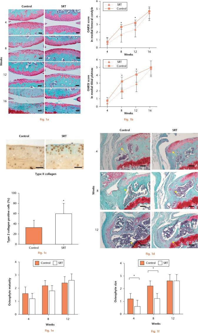 https://cdn.ncbi.nlm.nih.gov/pmc/blobs/d6dd/5987681/0ff16284d644/bonejointres-07-252-g001.jpg
