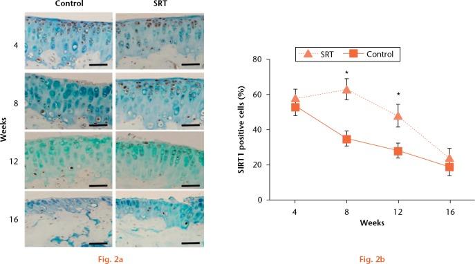 https://cdn.ncbi.nlm.nih.gov/pmc/blobs/d6dd/5987681/86844def04fb/bonejointres-07-252-g002.jpg