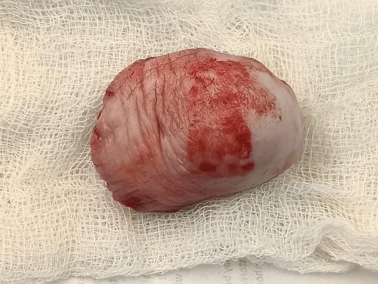 https://cdn.ncbi.nlm.nih.gov/pmc/blobs/d6f7/9872051/f44ba7235174/cureus-0014-00000032917-i06.jpg