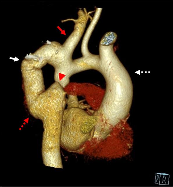 https://cdn.ncbi.nlm.nih.gov/pmc/blobs/d700/9482559/5cfdf7d3906a/42155_2022_327_Fig3_HTML.jpg