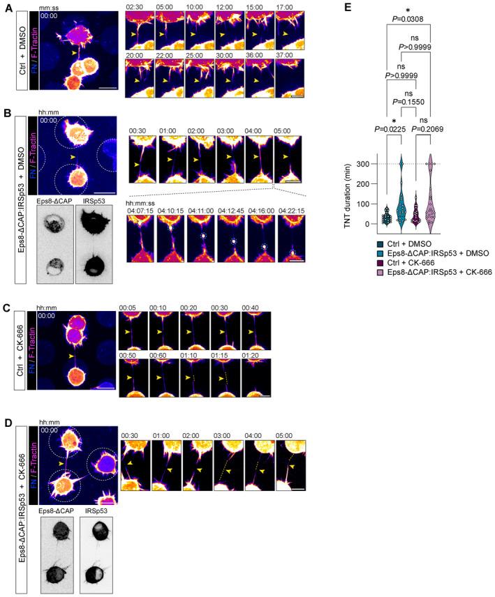 https://cdn.ncbi.nlm.nih.gov/pmc/blobs/d701/10711657/287fd4da2cd5/EMBJ-42-e113761-g014.jpg