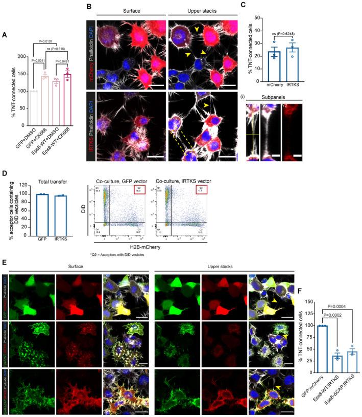 https://cdn.ncbi.nlm.nih.gov/pmc/blobs/d701/10711657/e992d186de82/EMBJ-42-e113761-g015.jpg