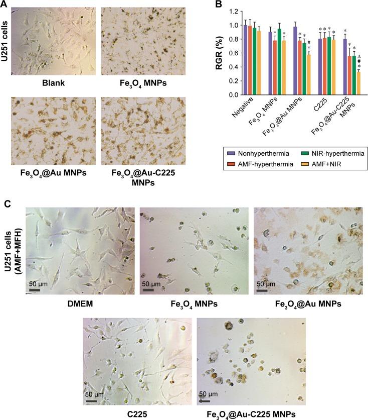 https://cdn.ncbi.nlm.nih.gov/pmc/blobs/d701/5922298/22dc3b25dba6/ijn-13-2491Fig6.jpg