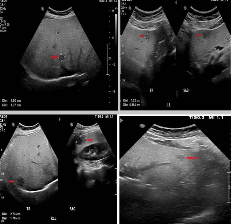 https://cdn.ncbi.nlm.nih.gov/pmc/blobs/d709/9891182/520b79507ae7/cureus-0015-00000033254-i01.jpg