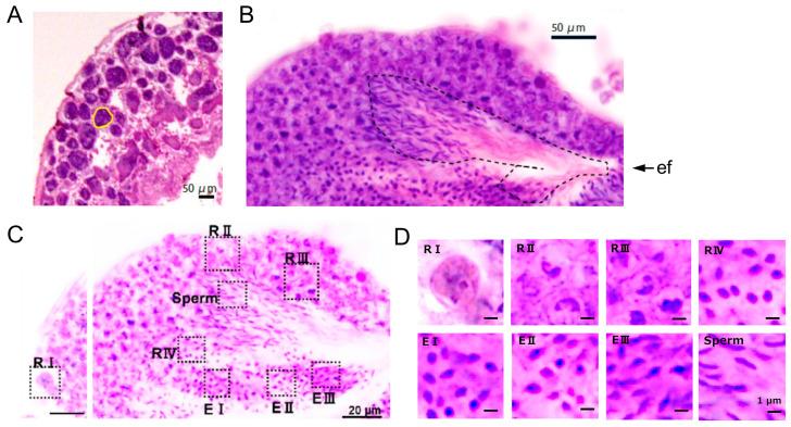 https://cdn.ncbi.nlm.nih.gov/pmc/blobs/d70c/11592721/ccd4093af9cc/cells-13-01863-g001.jpg