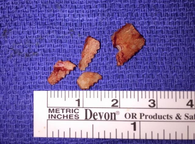 https://cdn.ncbi.nlm.nih.gov/pmc/blobs/d713/6475813/e7201862b31a/WJO-10-206-g003.jpg