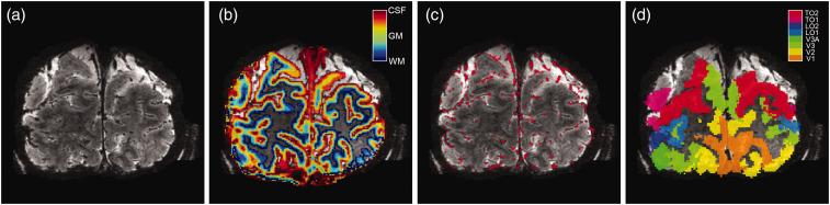 https://cdn.ncbi.nlm.nih.gov/pmc/blobs/d728/9941862/1bb06ef21208/10.1177_0271678X221133972-fig2.jpg